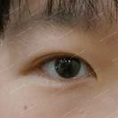 esEcsBeforeAfterTitle1 after