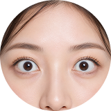 안검하수 초기 눈매