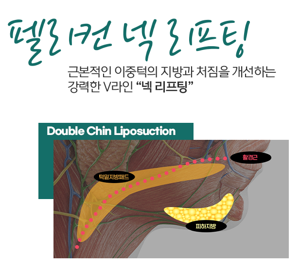 펠리컨성형